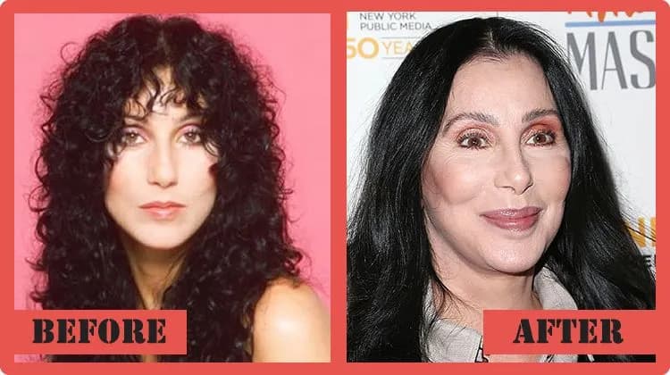 26 celebrytów, których urodę zniszczyły operacje kosmetyczne – szokujące metamorfozy