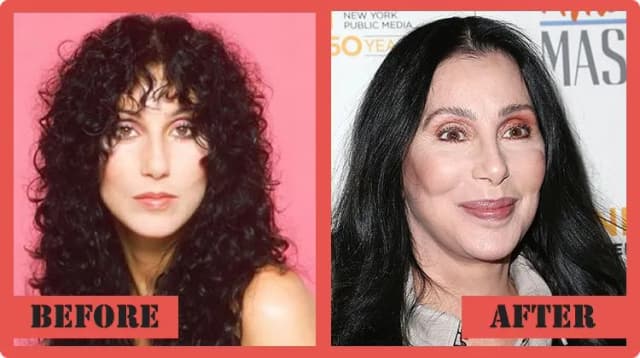 26 celebrytów, których urodę zniszczyły operacje kosmetyczne – szokujące metamorfozy