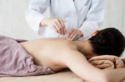 Akupunktura Kielce - Znajdź najlepsze usługi i specjalistów w mieście