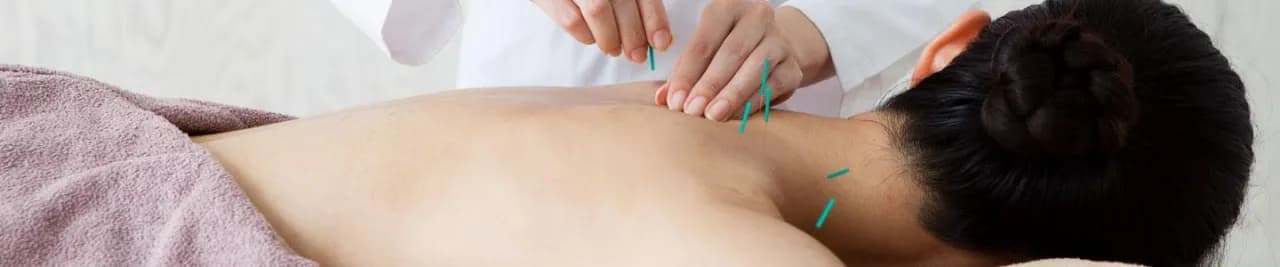 Akupunktura a niepłodność forum: Czy to naprawdę działa na płodność?